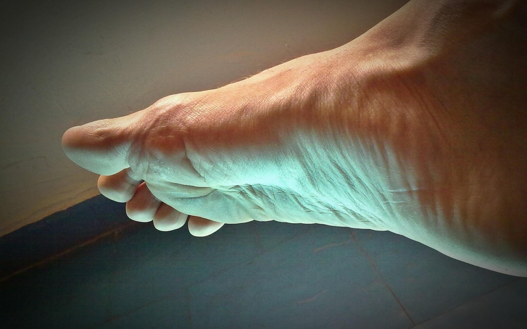 Rücken, Hüfte, Knie – Oft sind die Füße die Ursache für Schmerzen des gesamten Bewegungsapparats